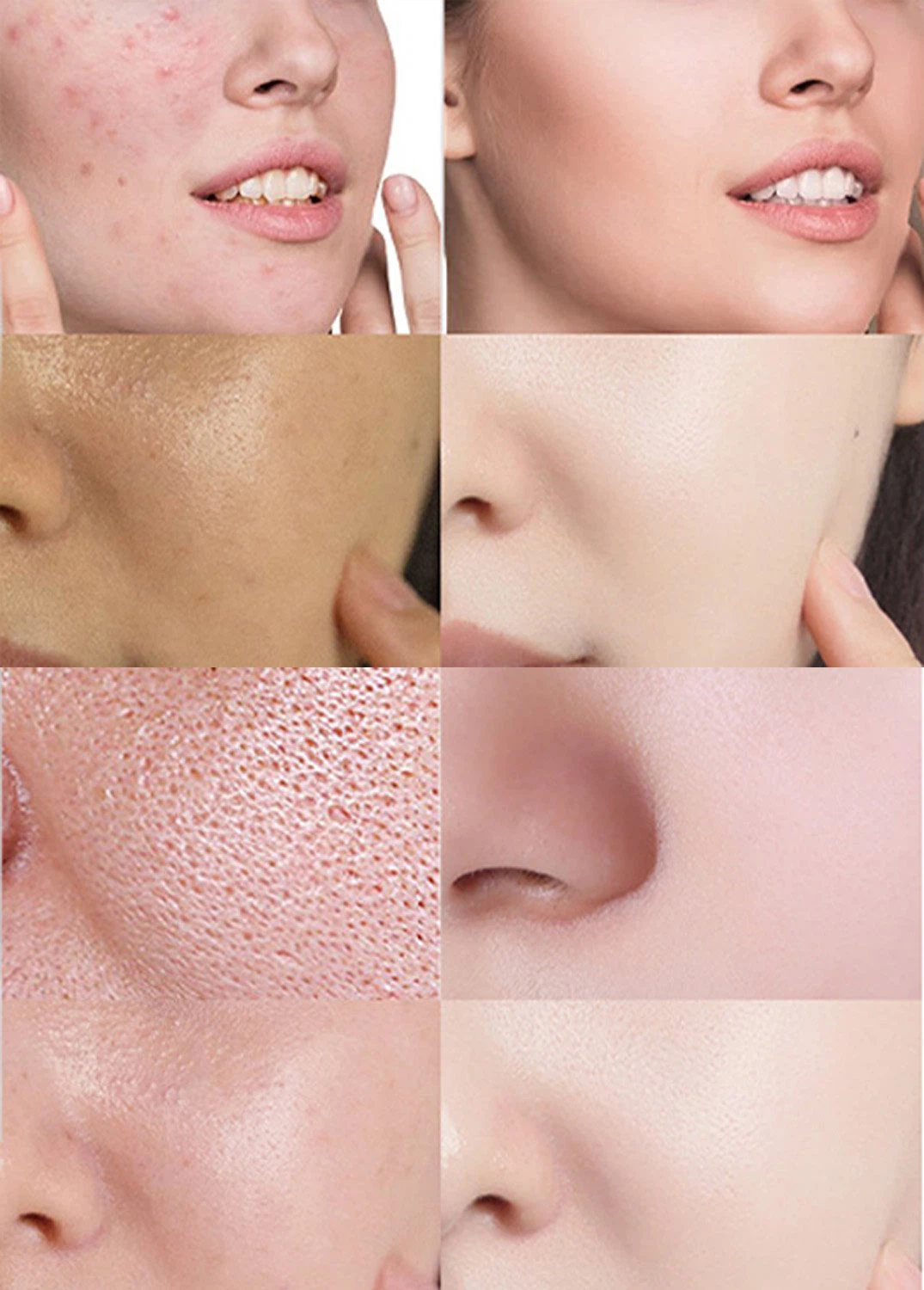 product-1075-1500 Salicylic acid 6